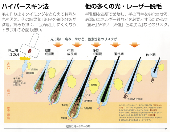 美肌脱毛サロンNa-Zu｜毛のメカニズム